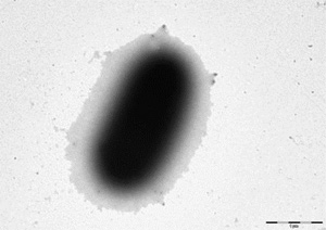 Micrografía de microscopio electrónico de transmisión de Haemophilus parasuis 